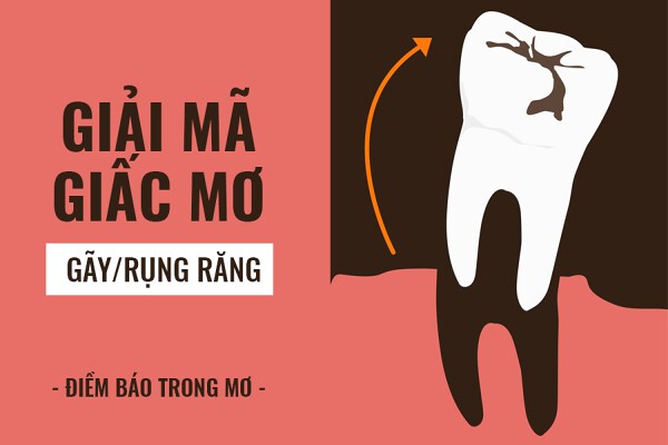 Nằm Mơ Rụng Răng – Giải Mã Tâm Linh Và Dự Báo Tương Lai